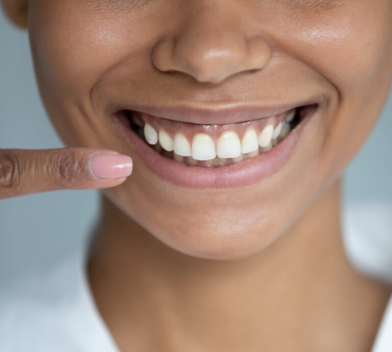 A Woman Pointing Her Finger At Her Smile